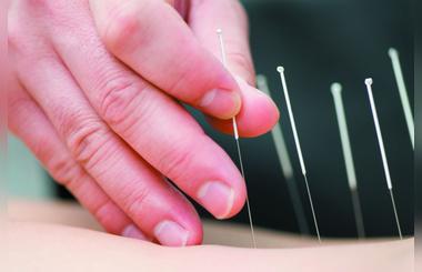 How to Fight Against Infertility With the Aid of Acupuncture