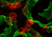 Mayo Clinic discovery reveals how lungs repair themselves, opening doors for regenerative therapies