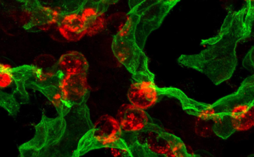 Mayo Clinic discovery reveals how lungs repair themselves, opening doors for regenerative therapies