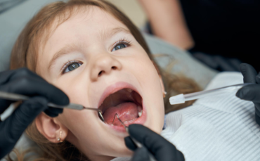 Do Baby Teeth Cavities Need Treatment? What Dubai Parents Should Know