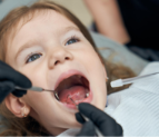Do Baby Teeth Cavities Need Treatment? What Dubai Parents Should Know