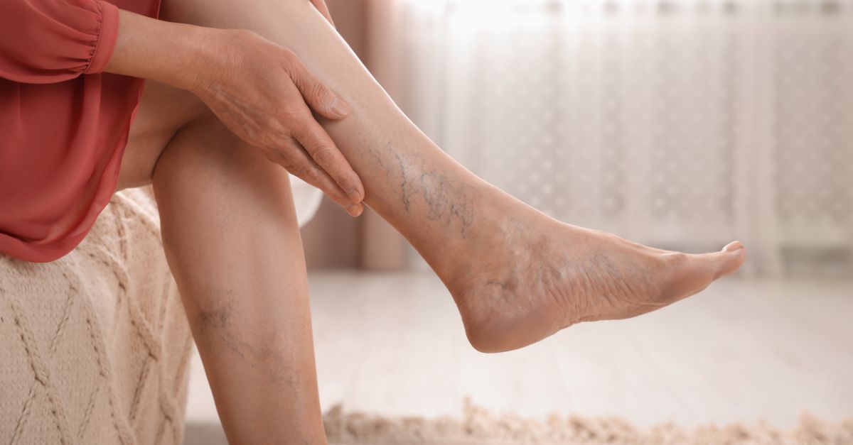 5 Simple Habits to Protect Your Legs If You're Always on Your Feet
