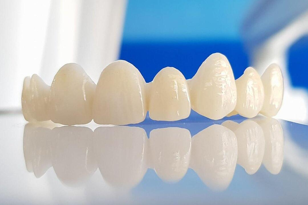 Zirconia Crown
