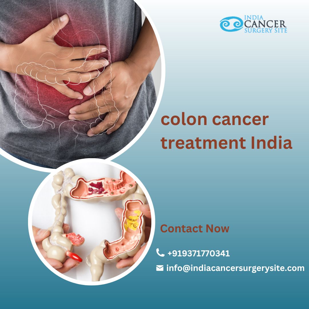 Best Colon Cancer Treatment in India