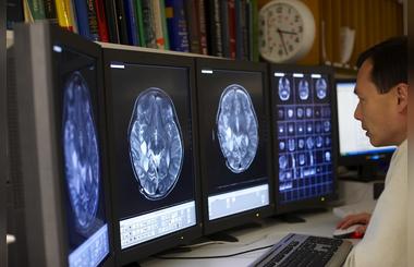 Study reveals that overweight children are more likely to have heart disease due to stiffer arteries