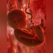 GOSH surgeons to play key role in foetal surgery project